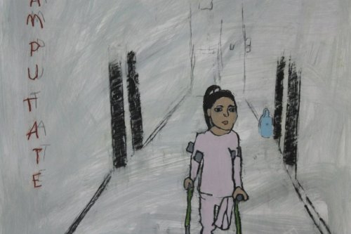 Amputee,  2025,  Acrylic, charcoal, and Conté crayon on paper, 23 by 17 inches
